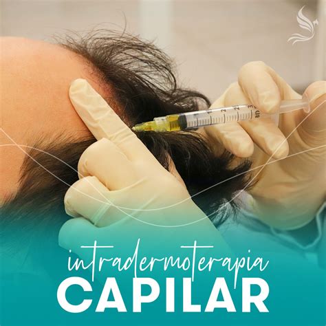 intradermoterapia capilar - betnovate capilar